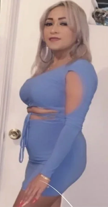 mommy-makeover-before-5